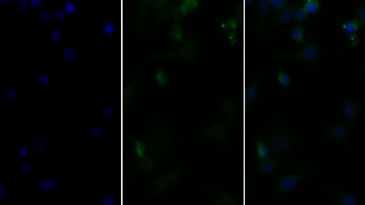 Monoclonal Antibody to Tumor Necrosis Factor Alpha (TNFa)