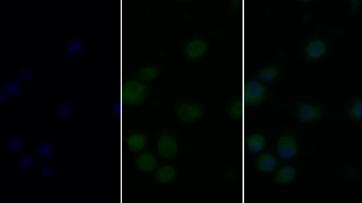 Monoclonal Antibody to Tumor Necrosis Factor Alpha (TNFa)