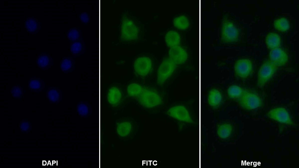 Monoclonal Antibody to Tumor Necrosis Factor Alpha (TNFa)