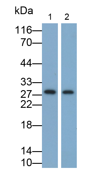 Monoclonal Antibody to Tumor Necrosis Factor Alpha (TNFa)