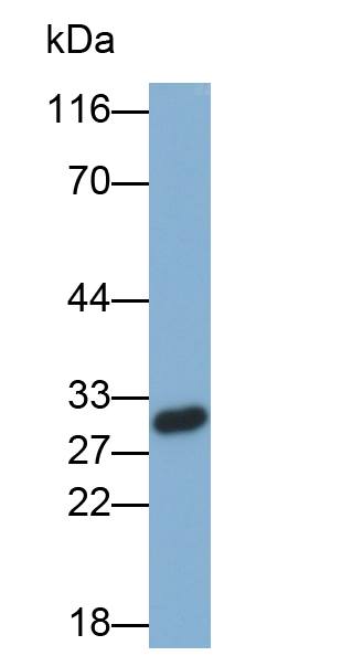 Monoclonal Antibody to Tumor Necrosis Factor Related Apoptosis Inducing Ligand (TRAIL)