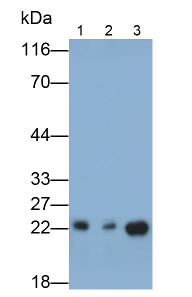 Monoclonal Antibody to Vascular Endothelial Growth Factor A (VEGFA)