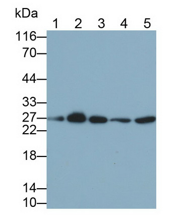 Monoclonal Antibody to Vascular Endothelial Growth Factor A (VEGFA)