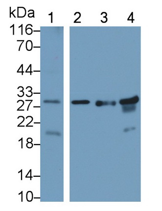 Monoclonal Antibody to Vascular Endothelial Growth Factor A (VEGFA)