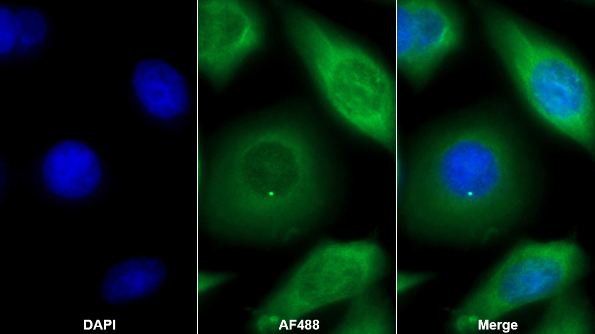 Monoclonal Antibody to Vascular Endothelial Growth Factor A (VEGFA)