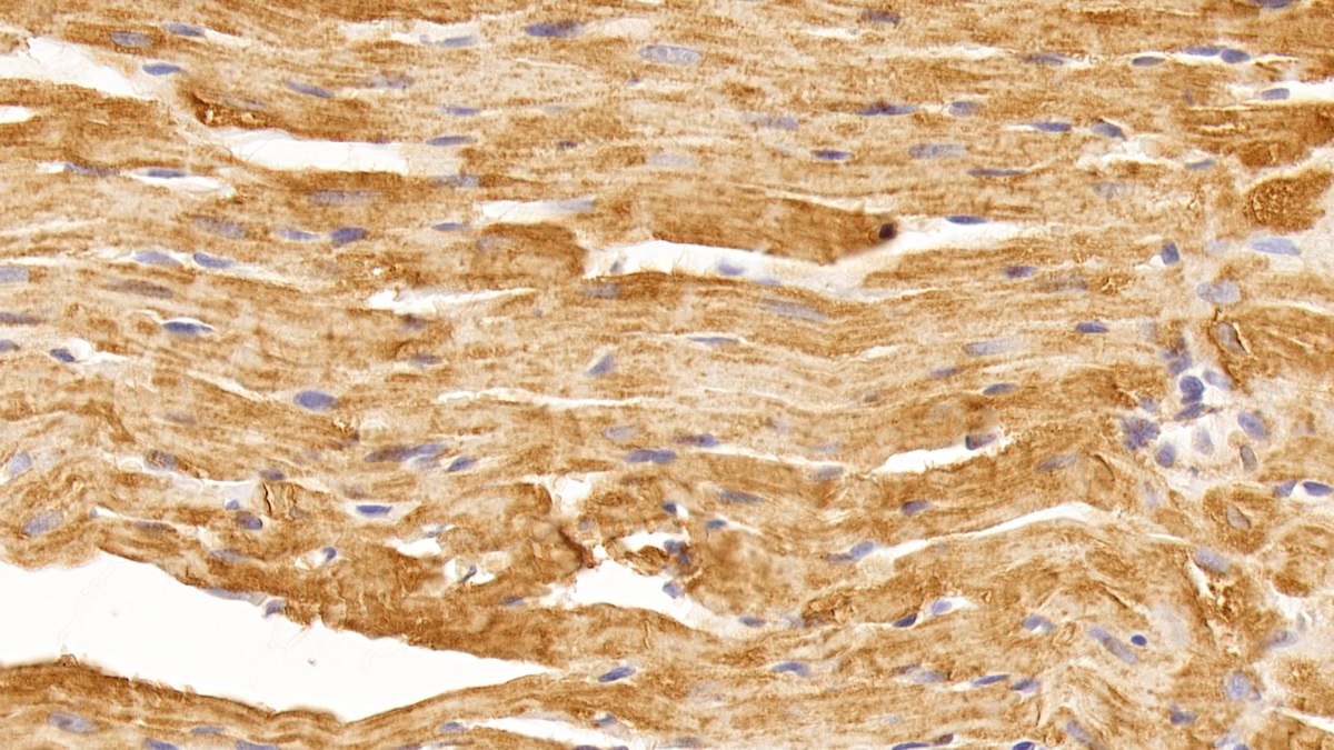 Monoclonal Antibody to Vascular Endothelial Growth Factor A (VEGFA)