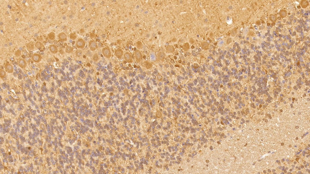 Monoclonal Antibody to Vascular Endothelial Growth Factor A (VEGFA)