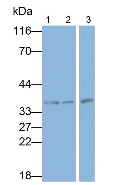 Monoclonal Antibody to Vascular Endothelial Growth Factor A (VEGFA)