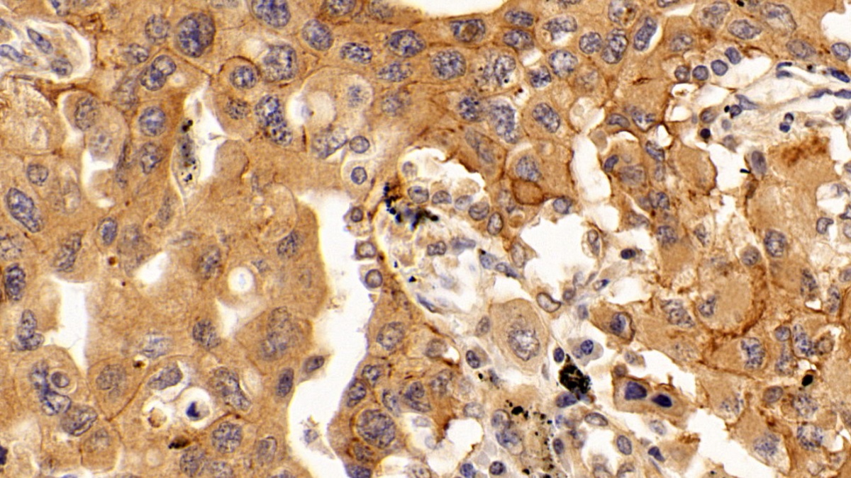 Monoclonal Antibody to Vascular Endothelial Growth Factor C (VEGFC)