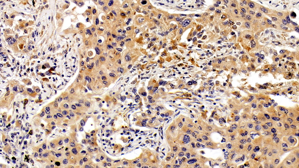 Monoclonal Antibody to Vascular Endothelial Growth Factor C (VEGFC)