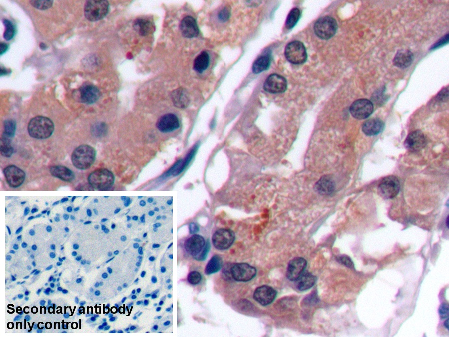 Monoclonal Antibody to Alpha-Fetoprotein (AFP)