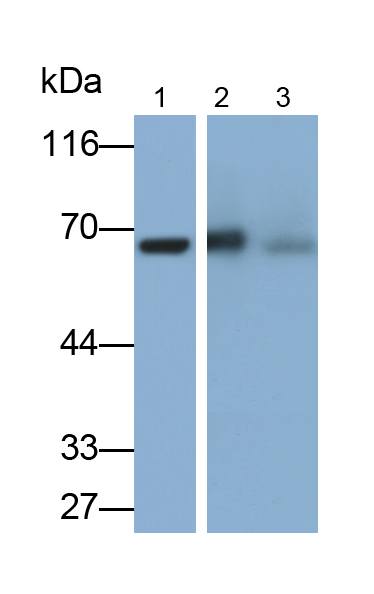 Monoclonal Antibody to Alpha-Fetoprotein (AFP)