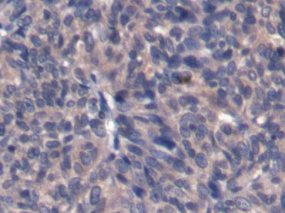 Monoclonal Antibody to Alpha-Fetoprotein (AFP)