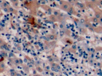 Monoclonal Antibody to Alpha-Fetoprotein (AFP)