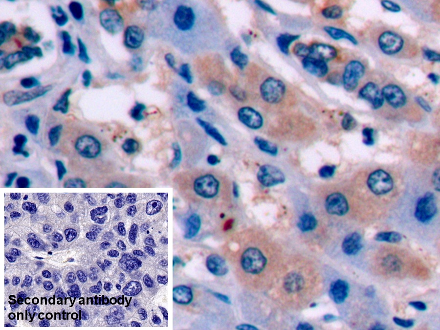 Monoclonal Antibody to Alpha-Fetoprotein (AFP)