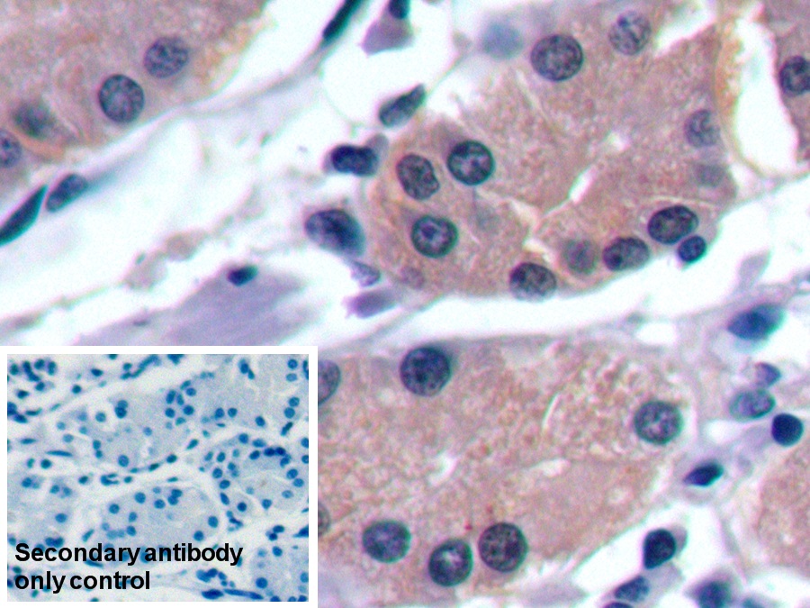 Monoclonal Antibody to Alpha-Fetoprotein (AFP)