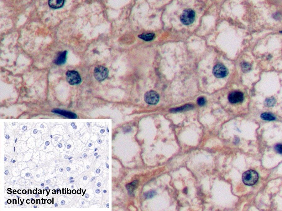 Monoclonal Antibody to Alpha-Fetoprotein (AFP)