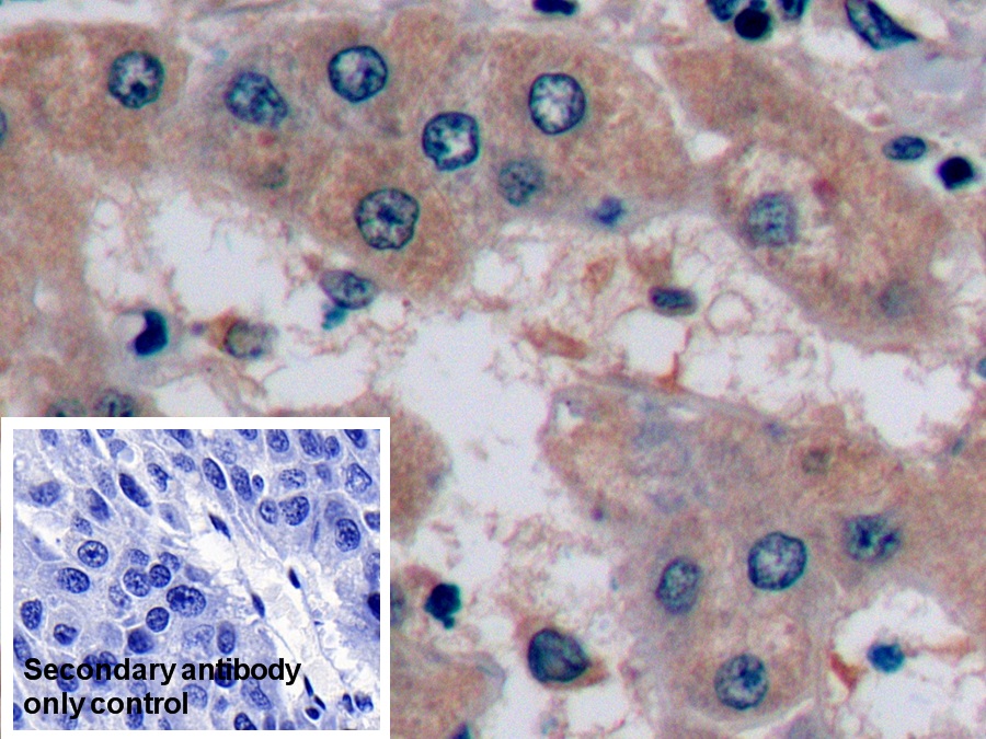 Monoclonal Antibody to Alpha-Fetoprotein (AFP)