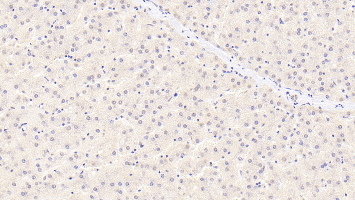 Monoclonal Antibody to Alpha 2-Antiplasmin (a2PI)