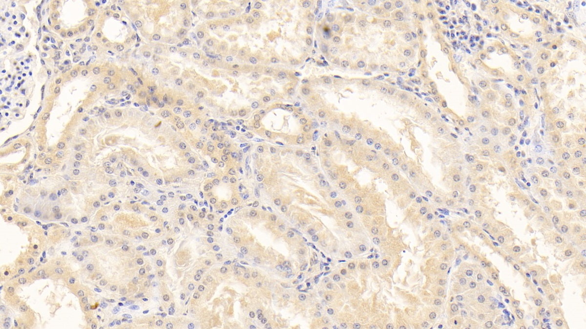 Monoclonal Antibody to Alpha 2-Antiplasmin (a2PI)