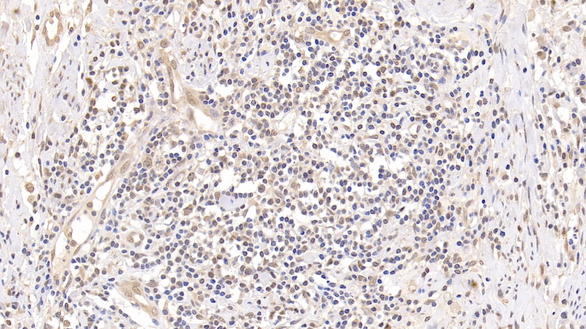 Monoclonal Antibody to Ubiquitin (Ub)