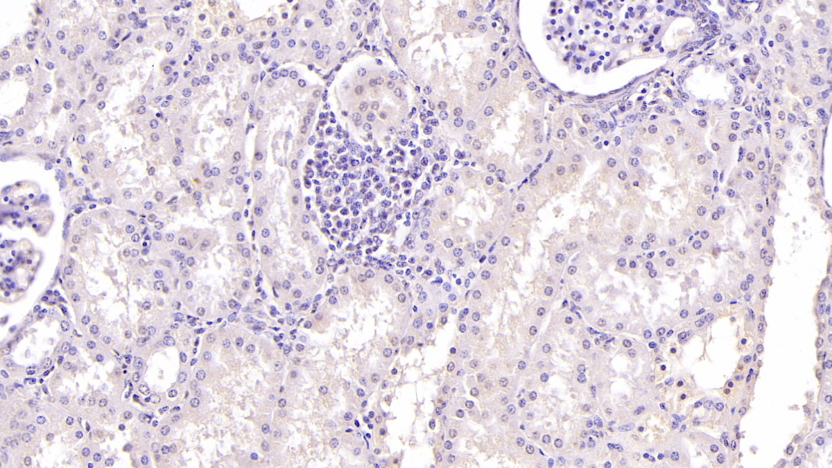 Monoclonal Antibody to Ubiquitin (Ub)