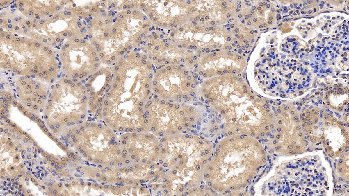 Monoclonal Antibody to Ubiquitin (Ub)