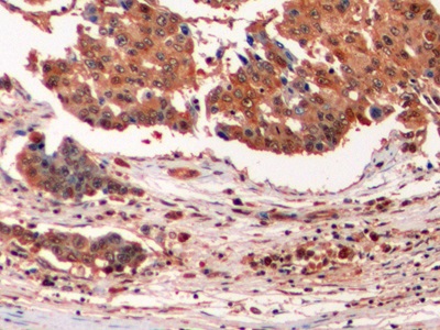 Monoclonal Antibody to Ubiquitin (Ub)