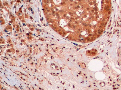 Monoclonal Antibody to Ubiquitin (Ub)