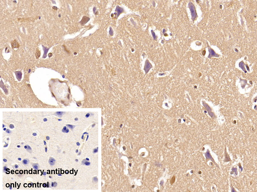 Monoclonal Antibody to Ubiquitin (Ub)