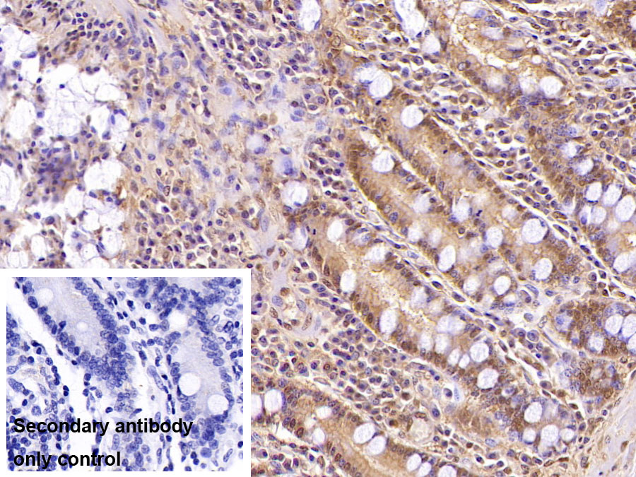 Monoclonal Antibody to Ubiquitin (Ub)