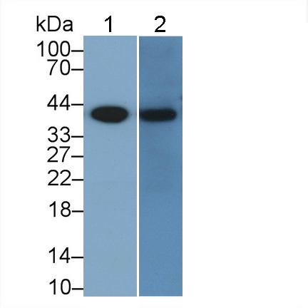 Monoclonal Antibody to Pepsinogen A (PGA)