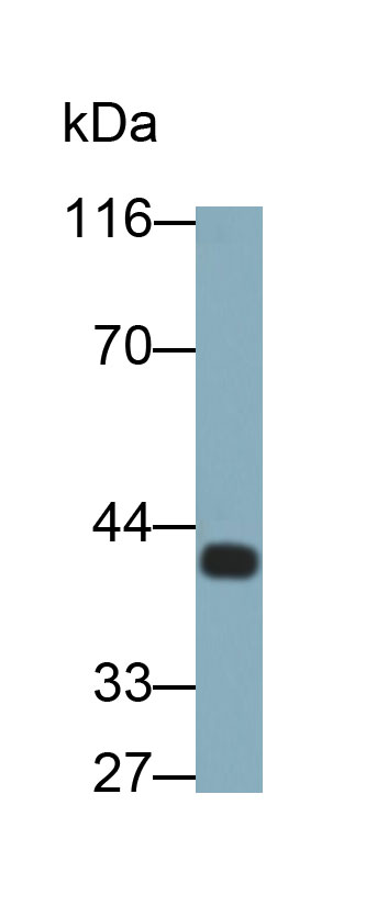 Monoclonal Antibody to Pepsinogen A (PGA)