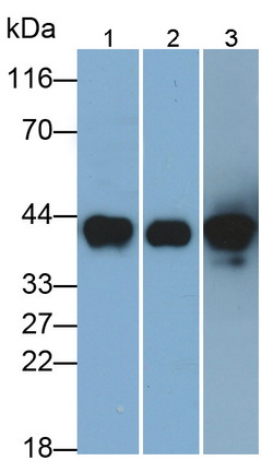 Monoclonal Antibody to Pepsinogen A (PGA)