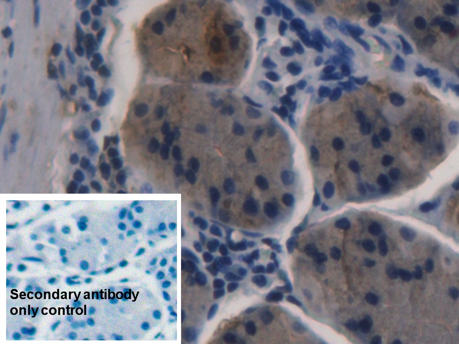 Monoclonal Antibody to Pepsinogen A (PGA)