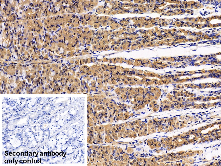 Monoclonal Antibody to Pepsinogen A (PGA)