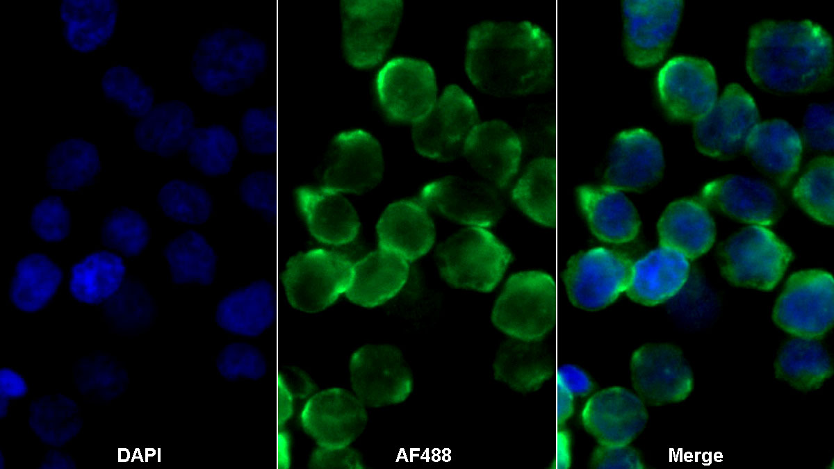 Monoclonal Antibody to Pepsinogen A (PGA)