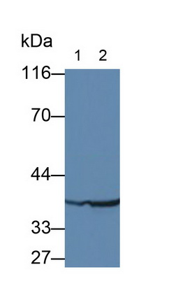 Monoclonal Antibody to Pepsinogen A (PGA)