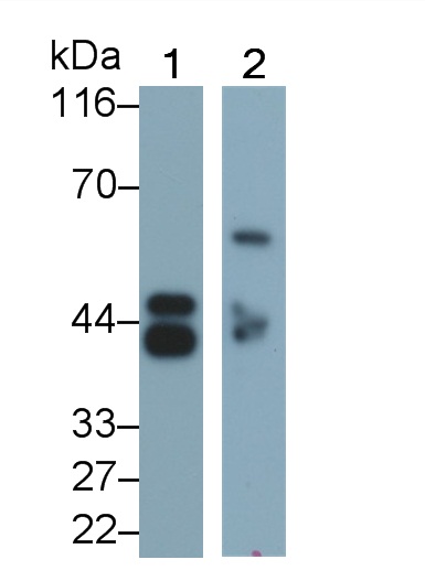 Monoclonal Antibody to Pepsinogen A (PGA)