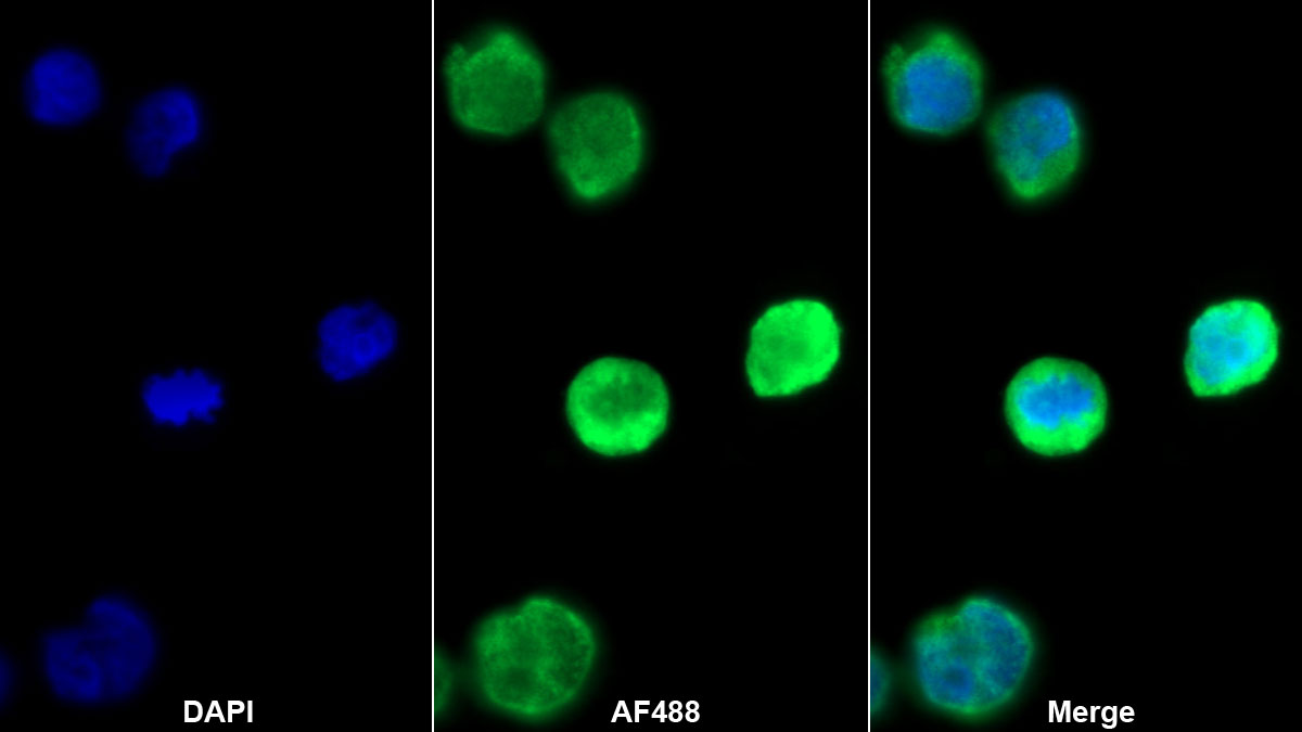 Monoclonal Antibody to Platelet Factor 4 (PF4)