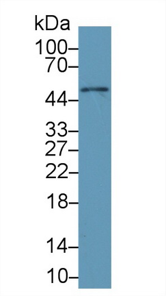 Monoclonal Antibody to Galactosidase Alpha (GLa)