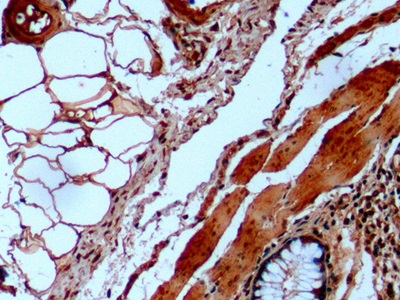 Monoclonal Antibody to Galactosidase Alpha (GLa)