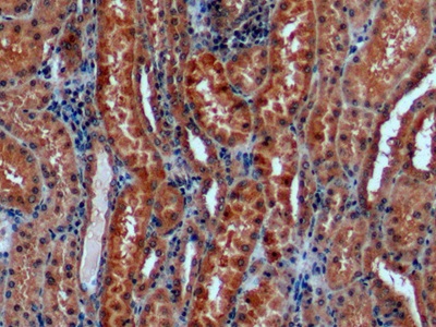 Monoclonal Antibody to Galactosidase Alpha (GLa)