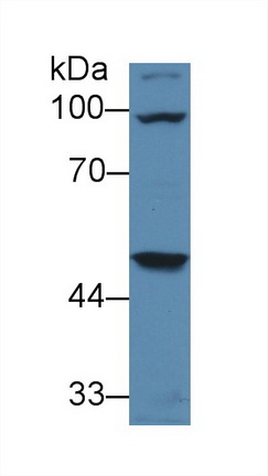 Monoclonal Antibody to Galactosidase Alpha (GLa)