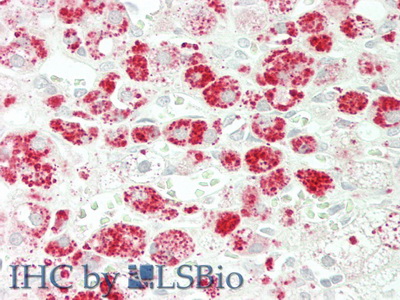 Monoclonal Antibody to Galactosidase Alpha (GLa)