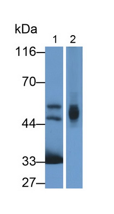 Monoclonal Antibody to Galactosidase Alpha (GLa)