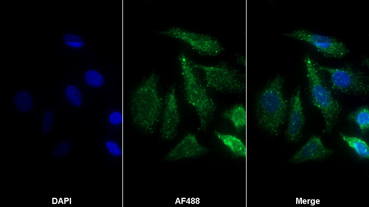 Monoclonal Antibody to Galactosidase Alpha (GLa)