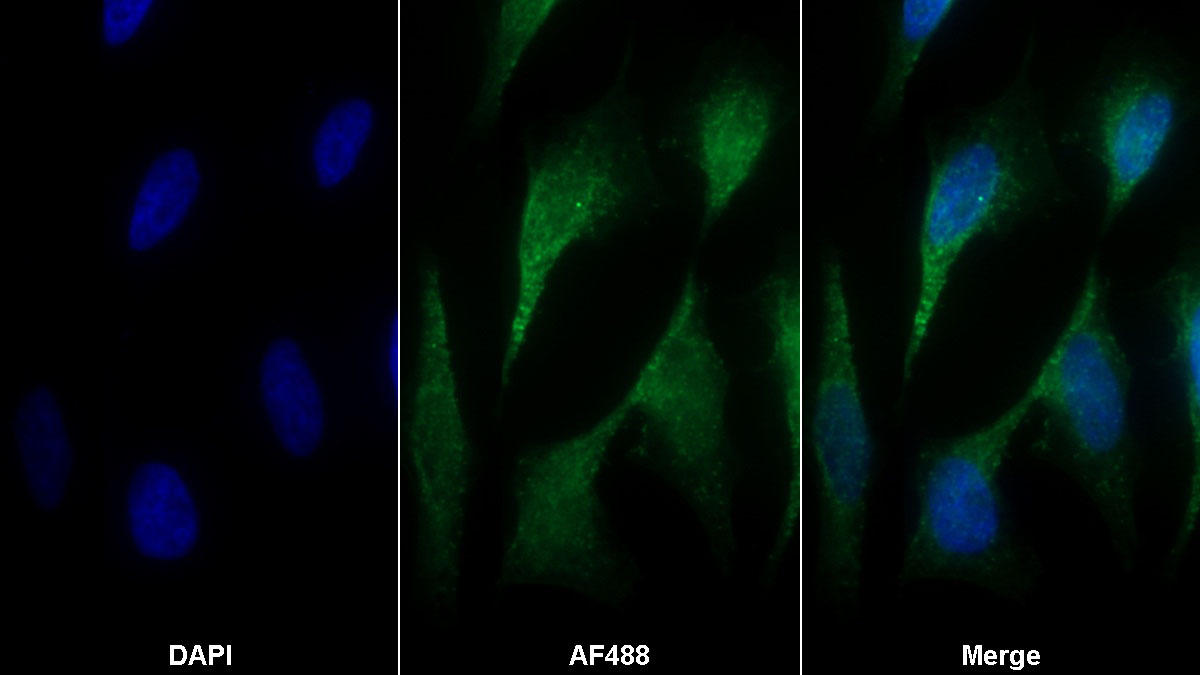 Monoclonal Antibody to Galactosidase Alpha (GLa)