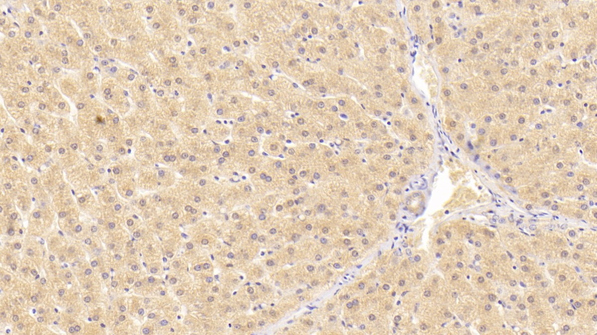 Monoclonal Antibody to Alanine Aminotransferase (ALT)