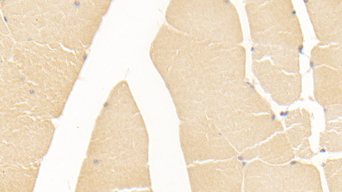 Monoclonal Antibody to Alanine Aminotransferase (ALT)